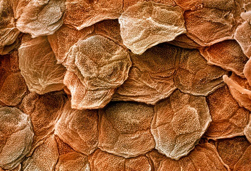 Эпидермис под микроскопом